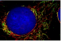 Zellkontrolle der Mitochondrien entschlüsselt 