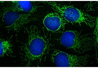  Eiweißmoleküle in Mitochondrien erstmals klar zugeordnet 