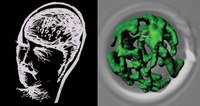Wie Alzheimer-Eiweiße die Zellkraftwerke lahmlegen