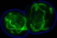 Helping to Transport Proteins Inside the Cell 