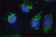 Protein kinase DYRK1A identified as a central integrator and synchronizer of the mitochondrial import machinery