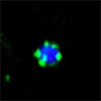 Researchers have a better understanding of how our cells dispose of waste while developing ways to control it